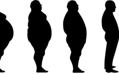 Abordaje multicomponente de la obesidad en el anciano