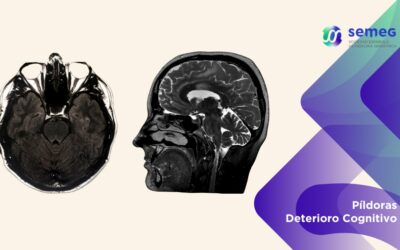 Una simple resonancia cerebral podría anticipar el riesgo de deterioro cognitivo