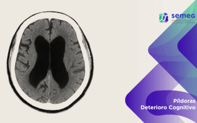 Posibles beneficios de la derivación ventriculoperitoneal en pacientes con hidrocefalia normotensiva