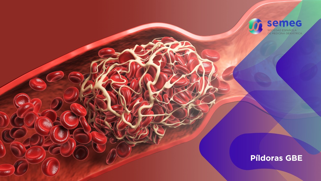 Anticoagulantes directos frente a antivitamina k