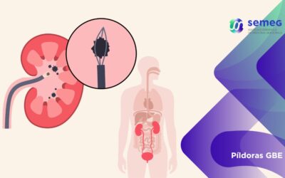 Cirugía endoscópica de litiasis en pacientes encamados