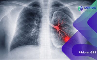 Tromboembolismo en cáncer de pulmón avanzado. Claves pronósticas en pacientes mayores