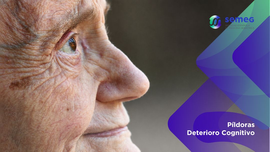 Agitación en Alzheimer